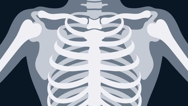 Cover image for: Chest X-Ray Interpretation