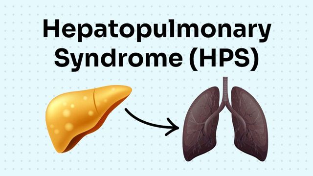 Cover image for: Hepatopulmonary Syndrome (HPS)