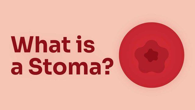 Image for What is a Stoma?
