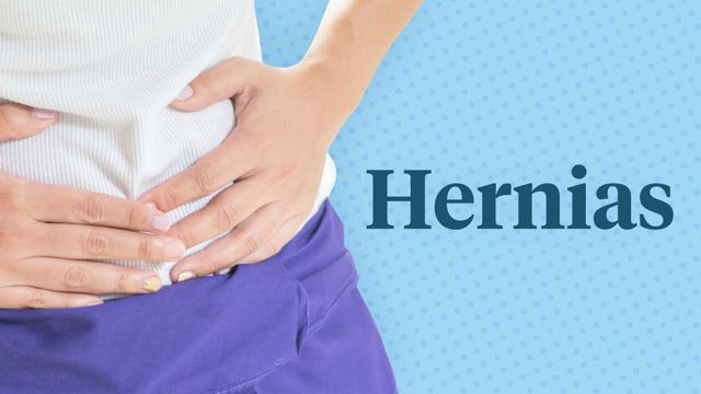 Image for Hernia Prevention and Management