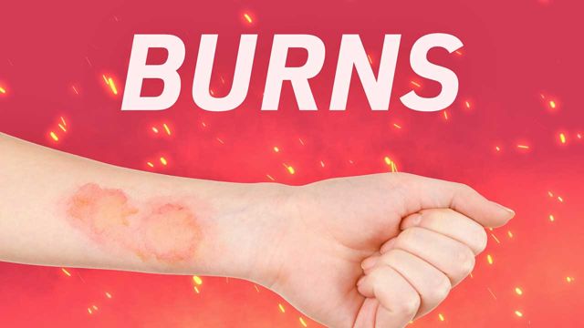 Image for General Management Principles of Burns