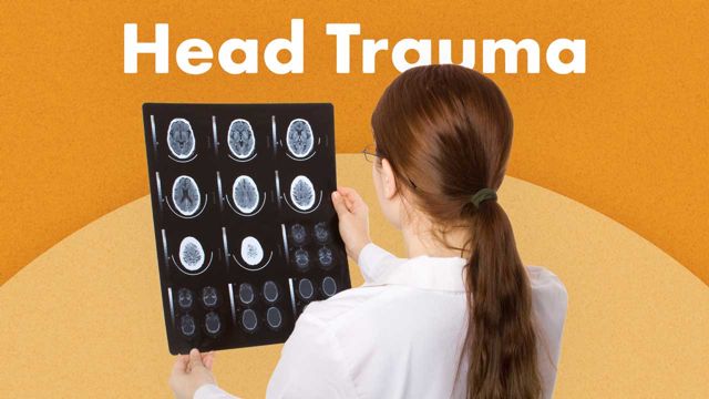 Cover image for: Head Trauma