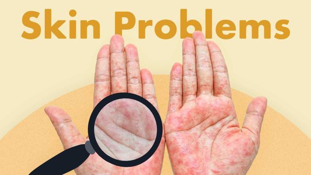 Cover image for: Skin Problems
