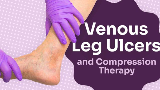 Image for Venous Leg Ulcers and Compression Therapy