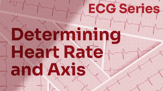Image for ECG Series: Determining Heart Rate and Axis