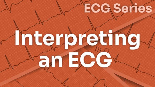 Cover image for: ECG Series: Interpreting an ECG