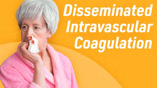 Image for Disseminated Intravascular Coagulation (DIC)