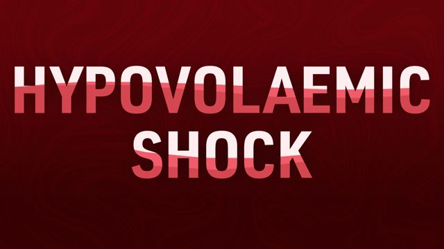Image for Recognising and Managing Hypovolaemic Shock 