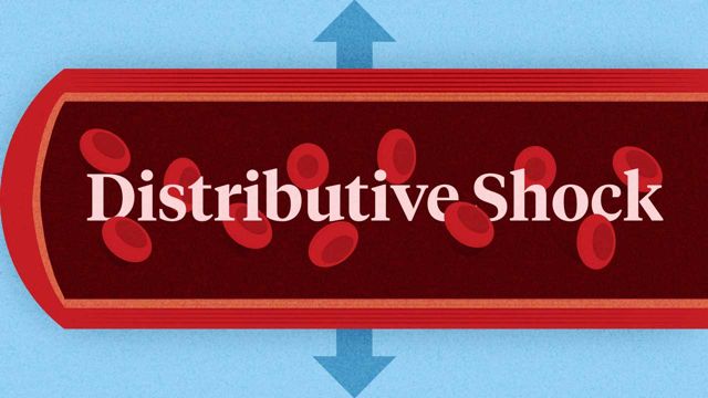 Image for Recognising and Managing Distributive Shock