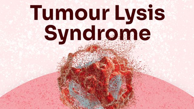 Cover image for: Tumour Lysis Syndrome