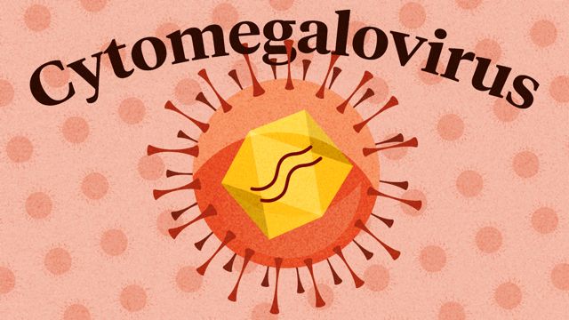 Cover image for: Cytomegalovirus (CMV)
