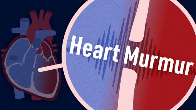 Cover image for: How to Identify Heart Murmurs