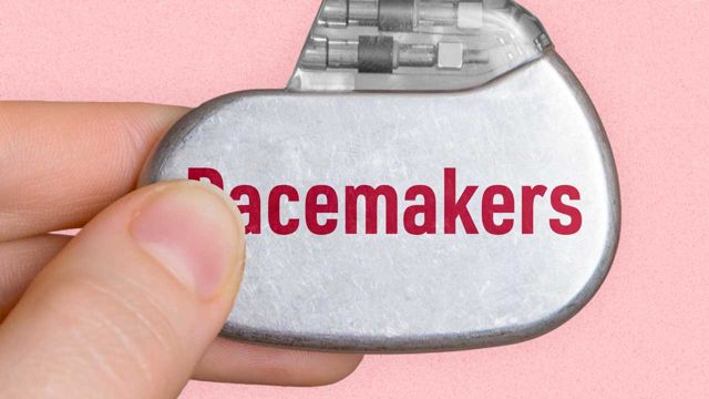 Image for Introduction to Pacemakers