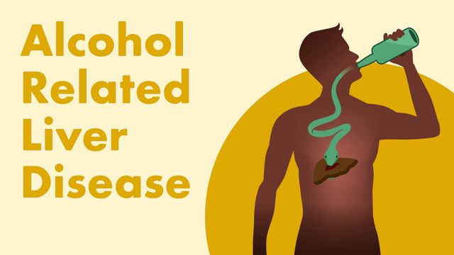 Alcohol Related Liver Disease Ausmed Lectures